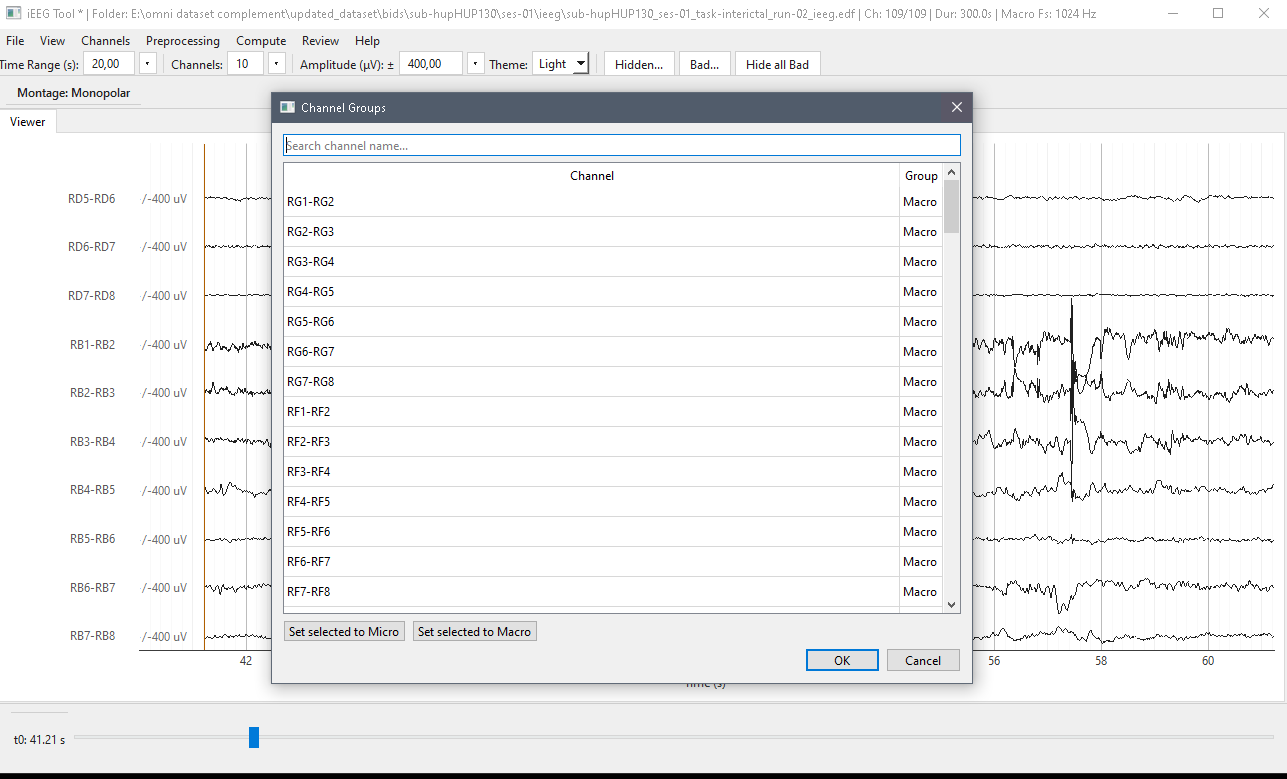 Channel Groups dialog for assigning Macro and Micro channels